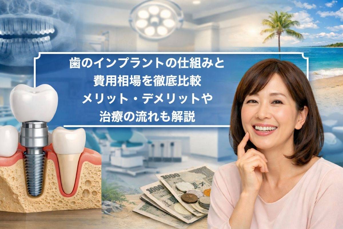歯のインプラントの仕組みと費用相場を徹底比較|メリット・デメリットや治療の流れも解説