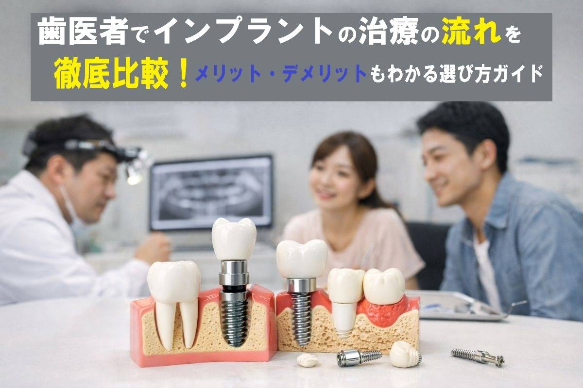歯医者でインプラントの治療の流れを徹底比較!メリット・デメリットもわかる選び方ガイド